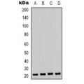 LifeSab™ HP1 gamma (pS93) Rabbit pAb (50 µl)