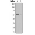 LifeSab™ RSAD1 Rabbit pAb (50 µl)