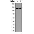 LifeSab™ SFRS15 Rabbit pAb (50 µl)