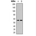 LifeSab™ CD276 Rabbit pAb (50 µl)
