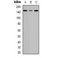 LifeSab™ Tensin 2 (pY483) Rabbit pAb (50 µl)