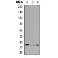 LifeSab™ RASD2 Rabbit pAb (50 µl)