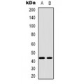 LifeSab™ TBX1 Rabbit pAb (50 µl)