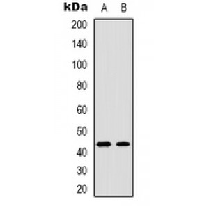 LifeSab™ TBX1 Rabbit pAb (50 µl)