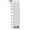 LifeSab™ Adenylate Kinase 6 Rabbit pAb (50 µl)