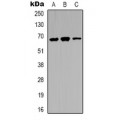 LifeSab™ IRAK3 Rabbit pAb (50 µl)