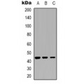 LifeSab™ Cathepsin D Rabbit pAb (50 µl)