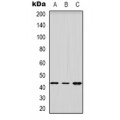 LifeSab™ HSD3B2 Rabbit pAb (50 µl)