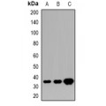 LifeSab™ HOXD13 Rabbit pAb (50 µl)