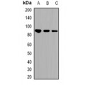 LifeSab™ STAT1 (AcK410/K413) Rabbit pAb (50 µl)