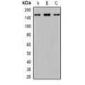 LifeSab™ GLI1 Rabbit pAb (50 µl)