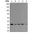 LifeSab™ LPAAT gamma Rabbit pAb (50 µl)