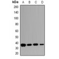 LifeSab™ Carbonic Anhydrase 13 Rabbit pAb (50 µl)