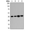 LifeSab™ RRP7A/B Rabbit pAb (50 µl)