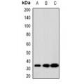 LifeSab™ SCP3 Rabbit pAb (50 µl)