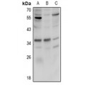 LifeSab™ FR beta Rabbit pAb (50 µl)