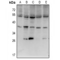 LifeSab™ ISG20L2 Rabbit pAb (50 µl)