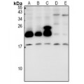 LifeSab™ Cytochrome b5B Rabbit pAb (50 µl)