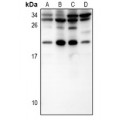 LifeSab™ IL-15 Rabbit pAb (50 µl)