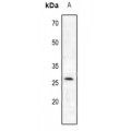 LifeSab™ Trypsin 2 Rabbit pAb (50 µl)