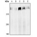 LifeSab™ Ki67 Rabbit pAb (50 µl)