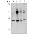 LifeSab™ Transglutaminase 3 Rabbit pAb (50 µl)