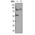 LifeSab™ ADAM12-S Rabbit pAb (50 µl)