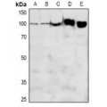 LifeSab™ ADAM12-L Rabbit pAb (50 µl)