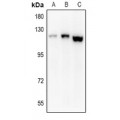 LifeSab™ EPHA8 Rabbit pAb (50 µl)