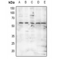 LifeSab™ MNK2 (pT249) Rabbit pAb (50 µl)
