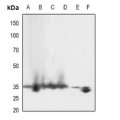 LifeSab™ LAT (pY161) Rabbit pAb (50 µl)