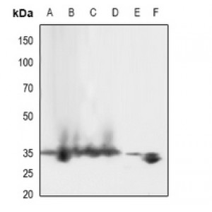 LifeSab™ LAT (pY161) Rabbit pAb (50 µl)