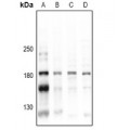 LifeSab™ CD45 (pY1216) Rabbit pAb (50 µl)
