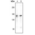 LifeSab™ nNOS (pS1417) Rabbit pAb (50 µl)