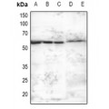 LifeSab™ MNK2 Rabbit pAb (50 µl)