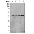 LifeSab™ OUTB1 (pS187) Rabbit pAb (50 µl)