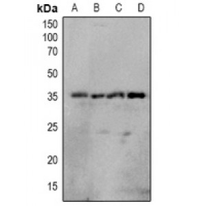 LifeSab™ OUTB1 (pS187) Rabbit pAb (50 µl)