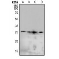 LifeSab™ Caveolin 2 (pY19) Rabbit pAb (50 µl)