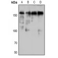 LifeSab™ DAP Kinase 1 (pS736) Rabbit pAb (50 µl)