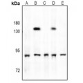 LifeSab™ TBK1 (pS172) Rabbit pAb (50 µl)