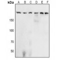 LifeSab™ Acinus (pS1180) Rabbit pAb (50 µl)