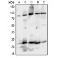 LifeSab™ EPHA8 Rabbit pAb (50 µl)