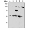 LifeSab™ PTP1B Rabbit pAb (50 µl)