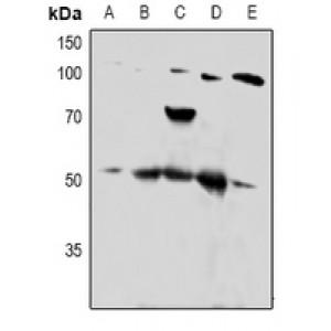 LifeSab™ PTP1B Rabbit pAb (50 µl)