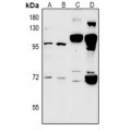 LifeSab™ CLIC6 Rabbit pAb (50 µl)