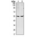 LifeSab™ CCDC102A Rabbit pAb (50 µl)