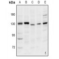LifeSab™ INT2 Rabbit pAb (50 µl)
