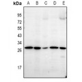 LifeSab™ LDLRAD1 Rabbit pAb (50 µl)