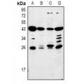 LifeSab™ Mannose Binding Protein Rabbit pAb (50 µl)