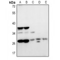 LifeSab™ NRBF2 Rabbit pAb (50 µl)